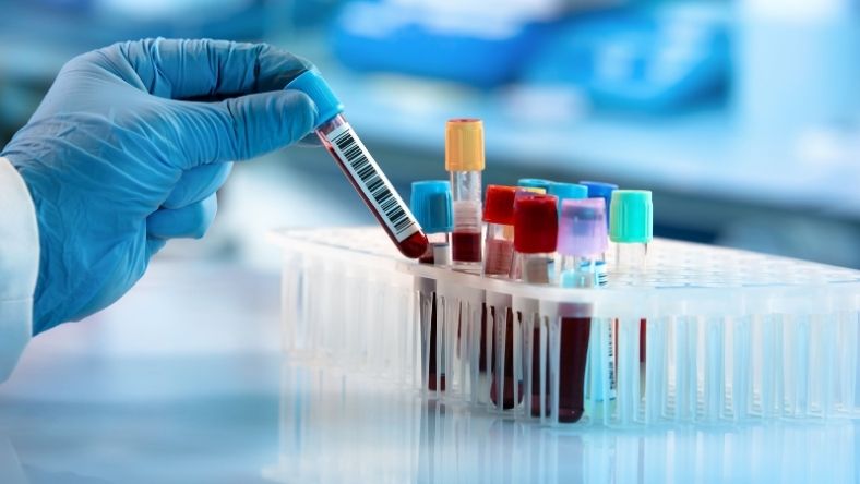 Gloved hand placing blood sample vial into laboratory test tube rack