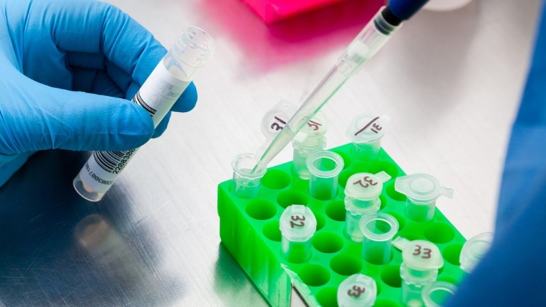 Scientist pipetting samples in biotech laboratory